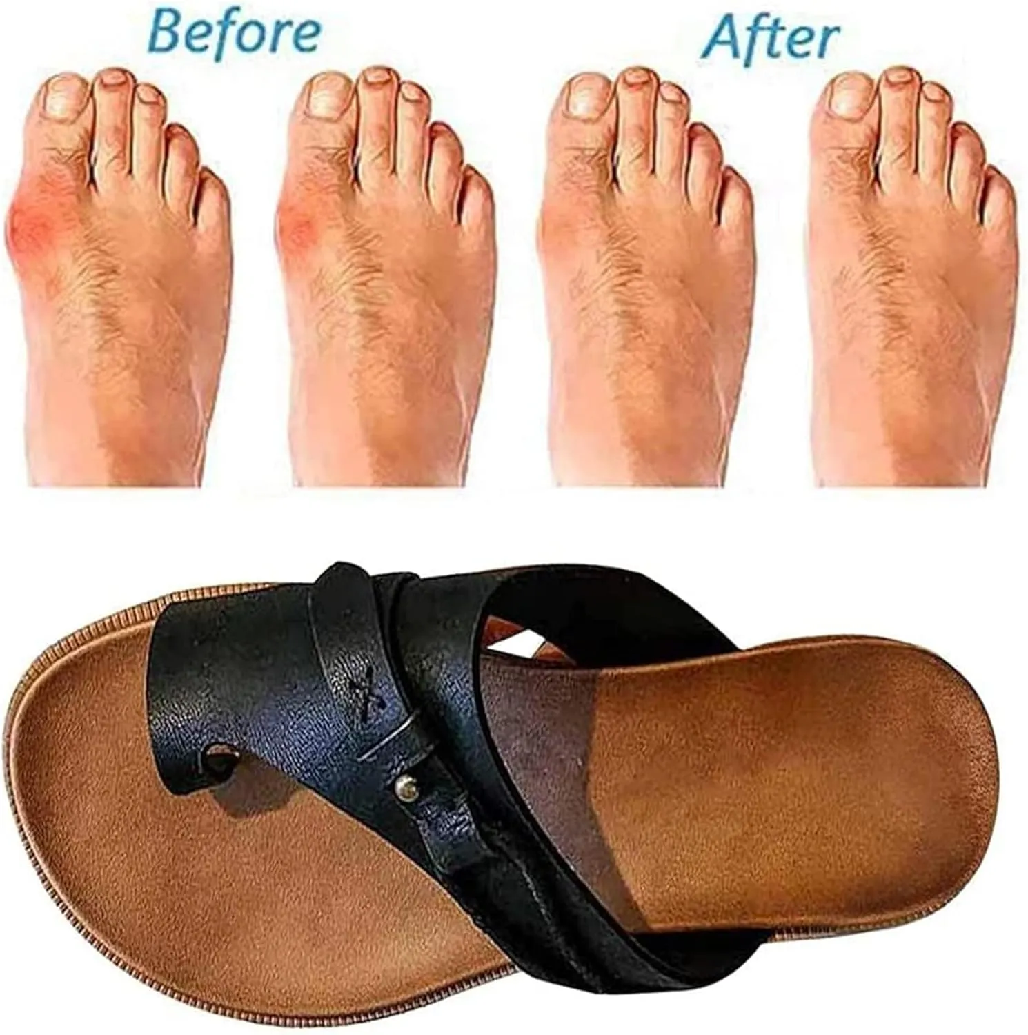 Women's Comfy Sandal Bunion Corrector Shoes Platform Soft Sole with Toe Arch Support Summer Breathable Casual Beach Travel Shoes,Silver,EU42/US10